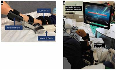 In-Bed Sensorimotor Rehabilitation in Early and Late Subacute Stroke Using a Wearable Elbow Robot: A Pilot Study